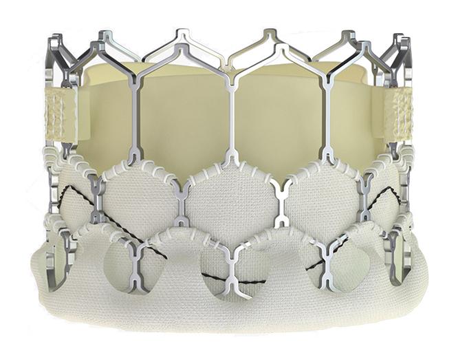 Система транскатетерного серцевого клапана Мівал (Myval) діаметр 32мм